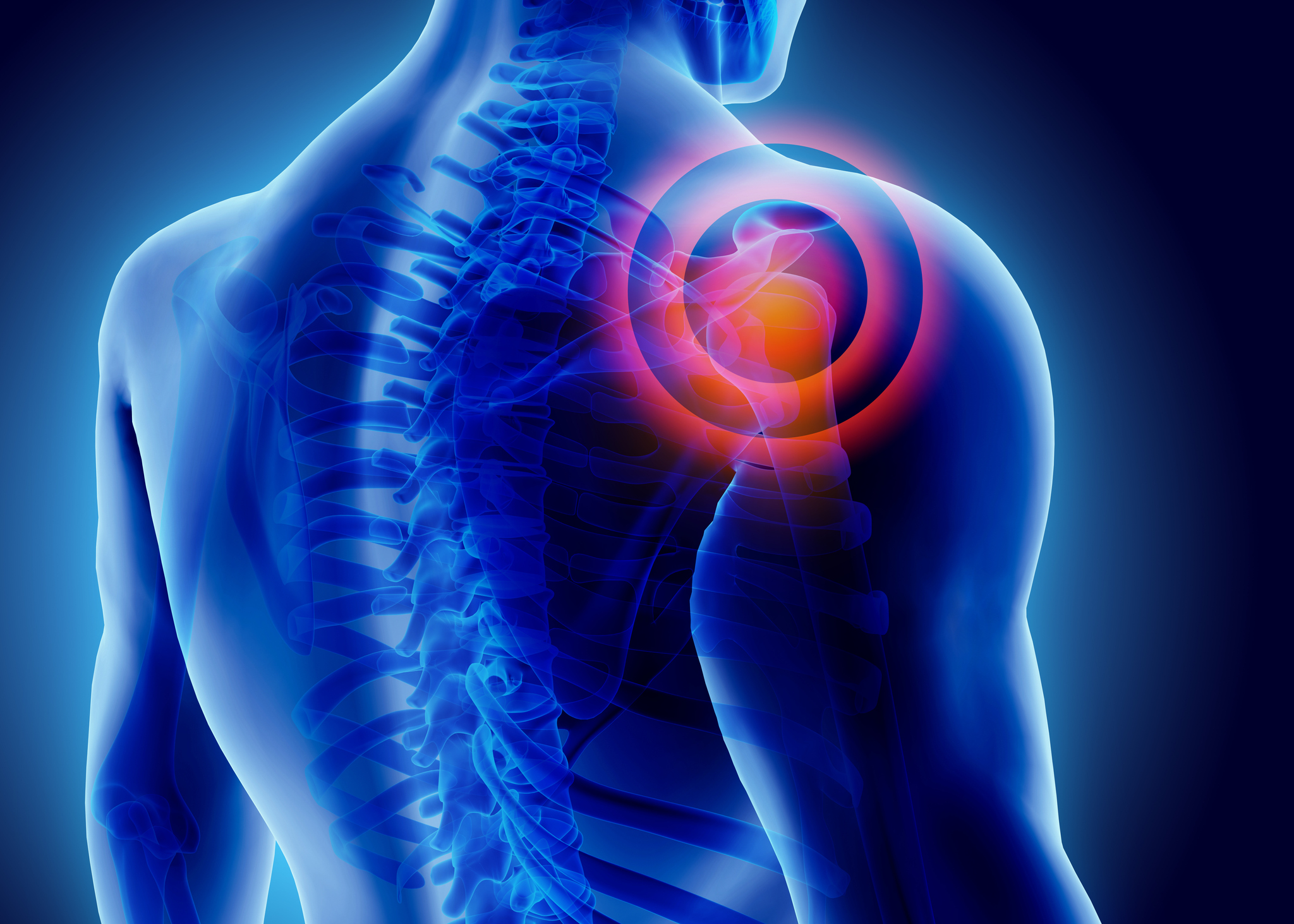 Shoulder Pain at Night