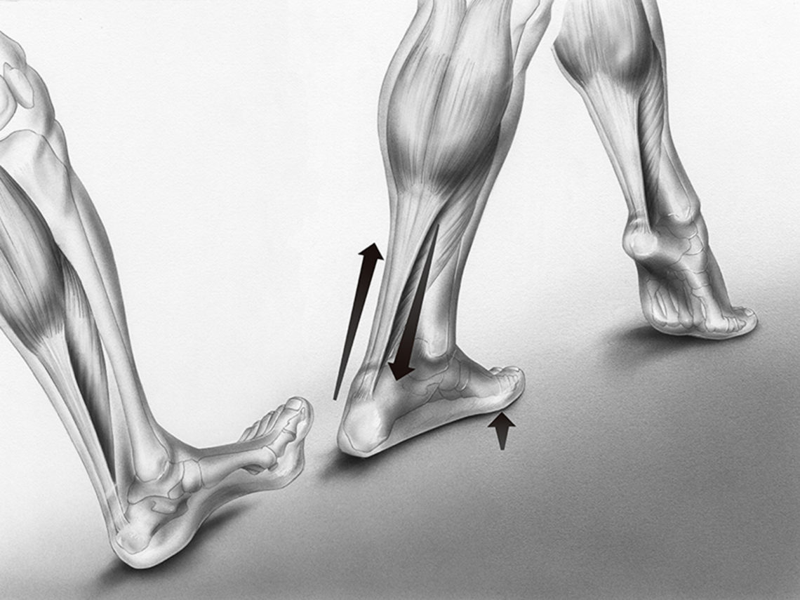 What Causes Achilles Tendonitis? - Health Journal