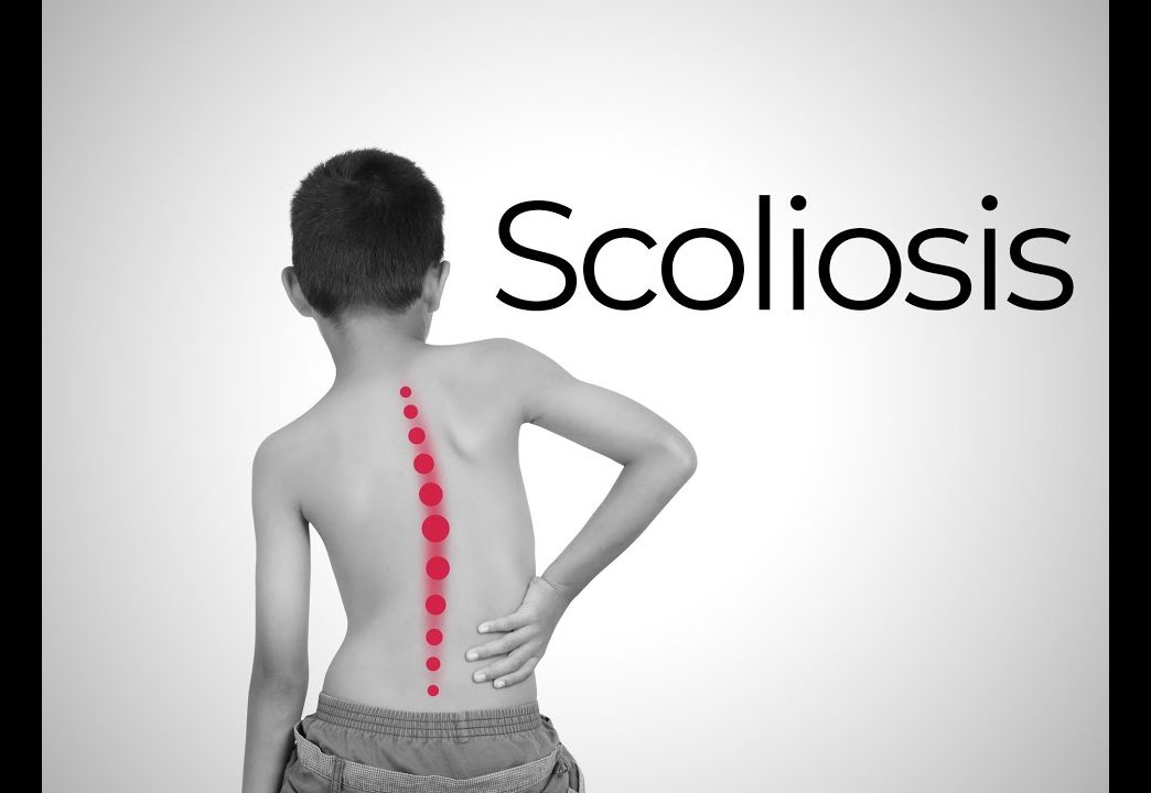 Scoliosis Health Journal 